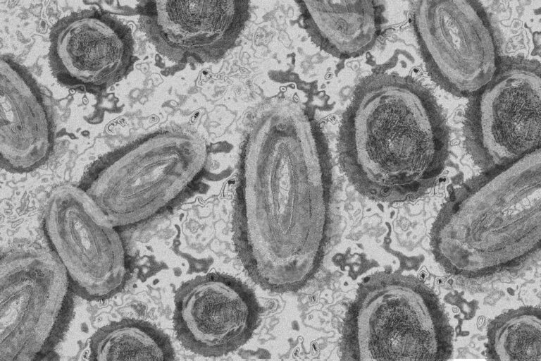 Das Mpox-Virus breitet sich in Afrika aus – doch der Westen beschlagnahmt den Impfstoff