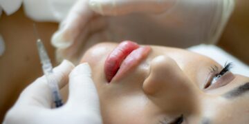 Weltweiter Anstieg bei Schönheitsoperationen