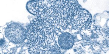Infektionen mit Nipah-Virus in Indien