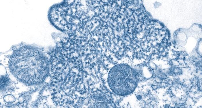 Infektionen mit Nipah-Virus in Indien