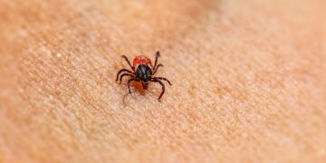 FSME: Hohe Durchseuchung bei Zecken mit Borrelien und steigendes Infektionsrisiko