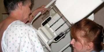 Präventive Brustkrebsuntersuchungen: Verbesserungsbedarf für Österreich